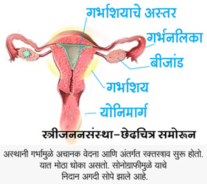 Female Reproductive Diagram